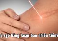 Trị sẹo bằng laser giá bao nhiêu?