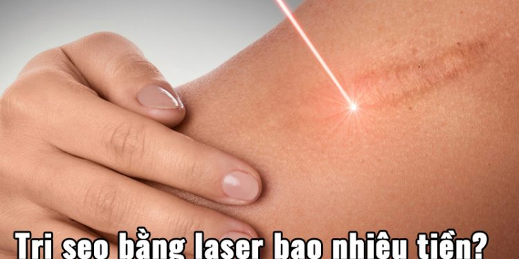 Trị sẹo bằng laser giá bao nhiêu?