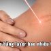 Trị sẹo bằng laser giá bao nhiêu?